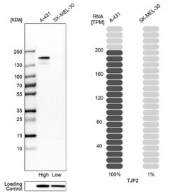 Tight Junction Protein 2 Antibody, Novus Biologicals 0.1mL; Unlabeled:Antibodies,